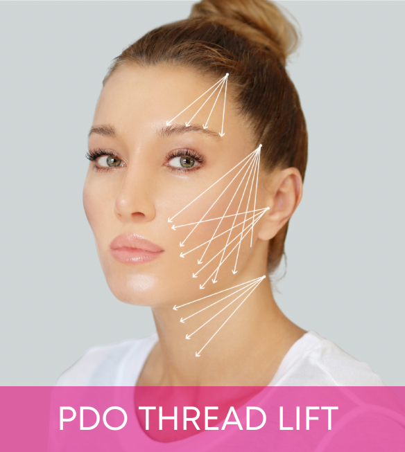 PDO Thread Lift PDO Thread Lift