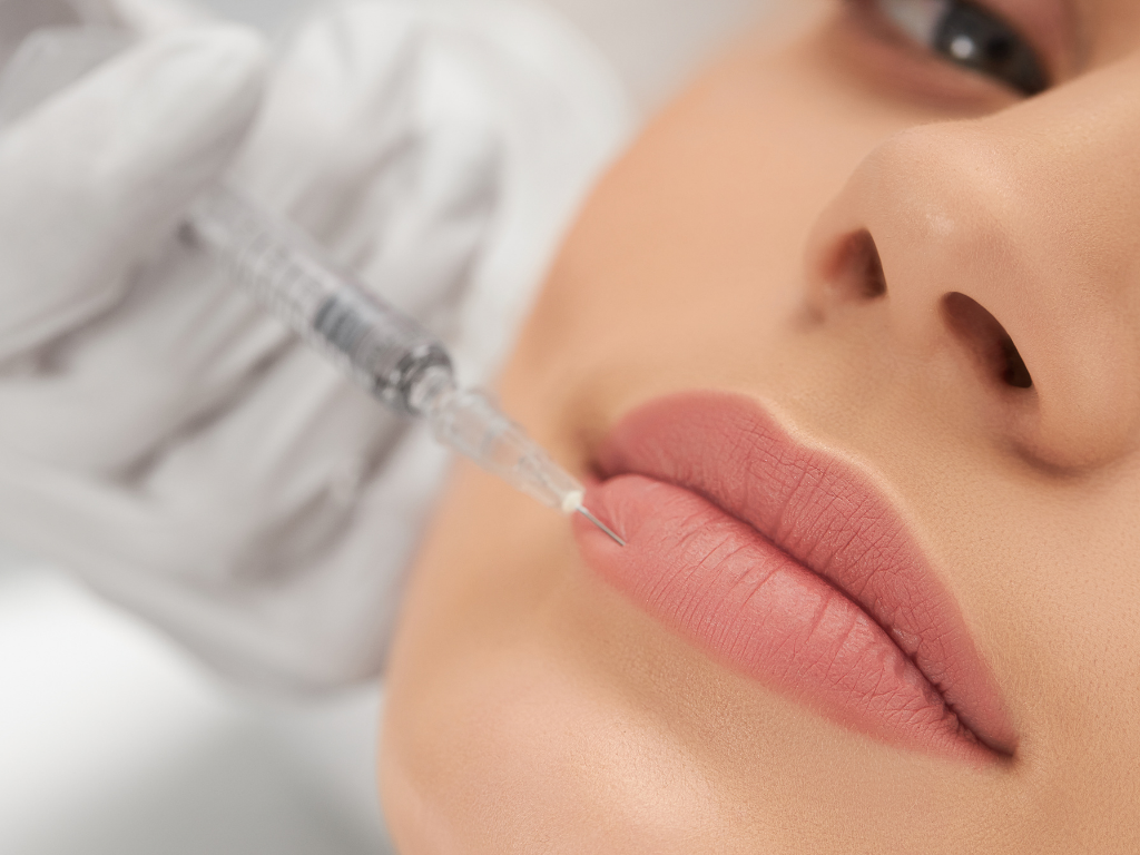 Lip Filler