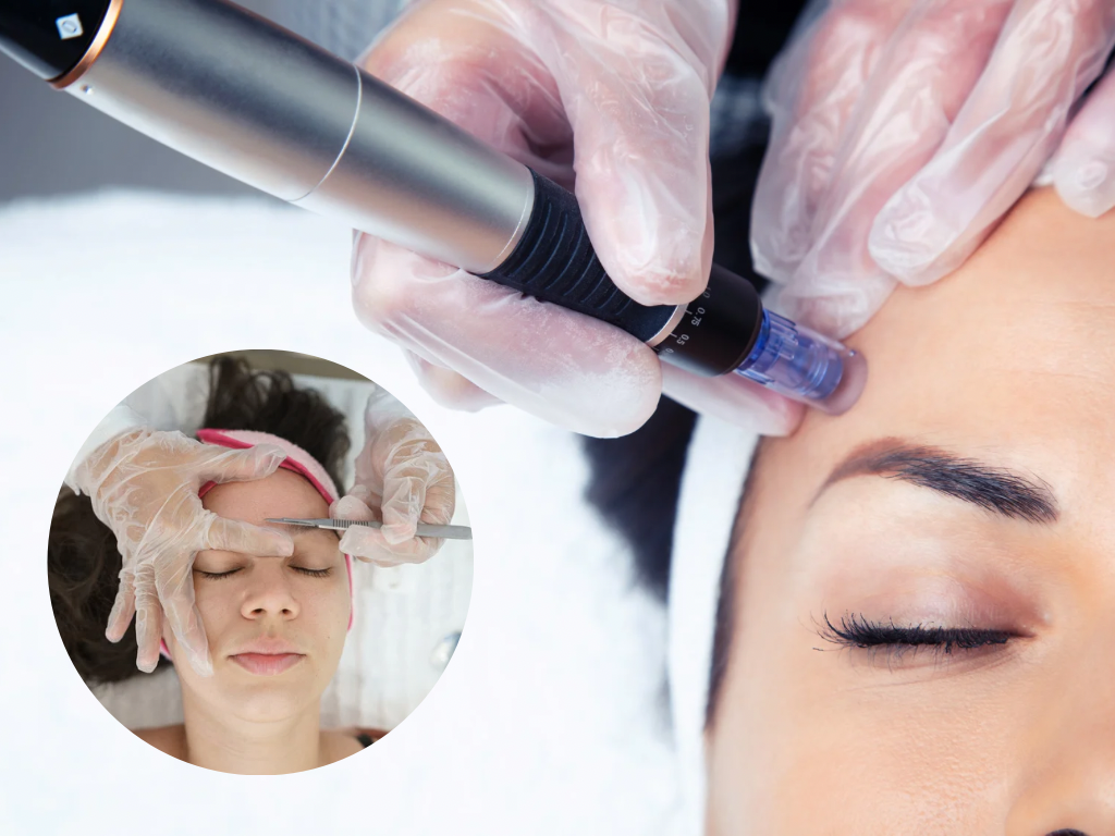 Dermaplaning & Microneedling Package